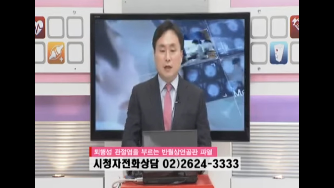퇴행성관절염을 부르는 반월상연골판파열