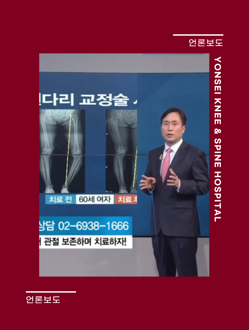 SBSCNBC < 건강플러스 > 무릎통증 내 관절 보존하며 치료하자! - 제진호 병원장 출연