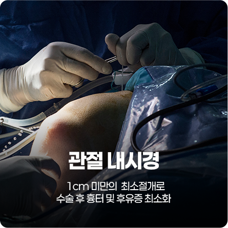 관절 내시경