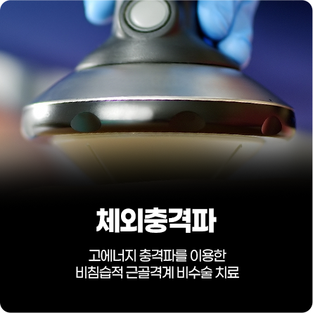 체외충격파